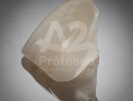 a2_proteses_1-Galeria